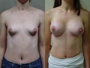 Before and After Image