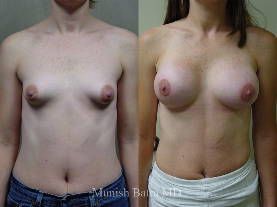 Before and After Image