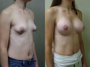Before and After Image