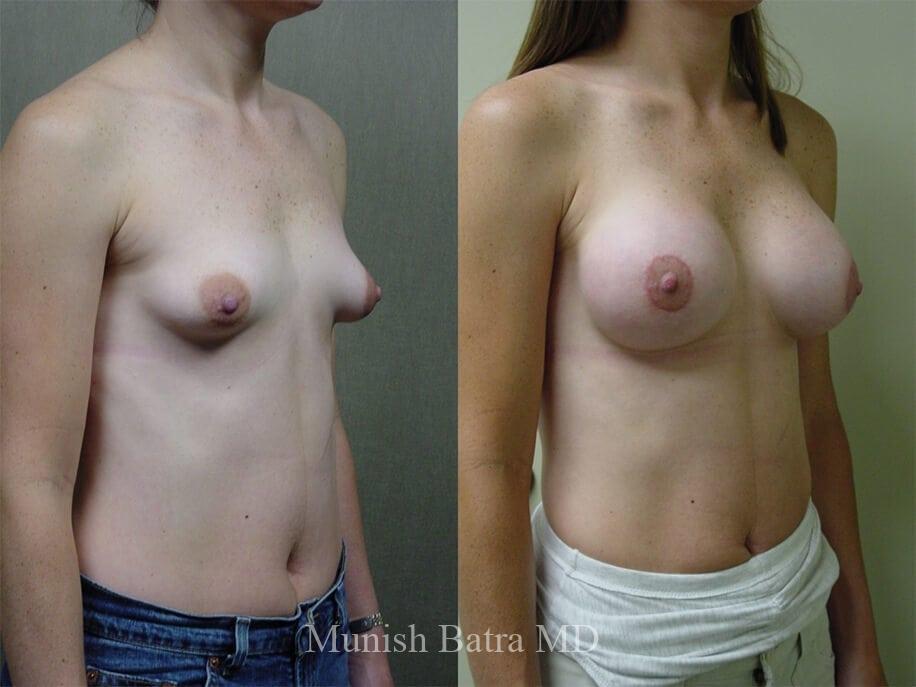 Before and After Image