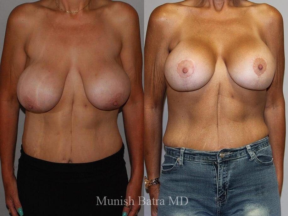 Before and After Image