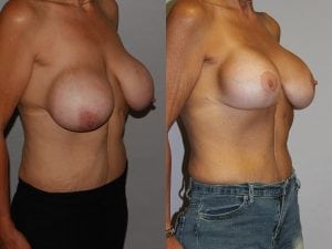 Before and After Image