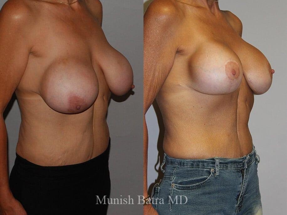 Before and After Image