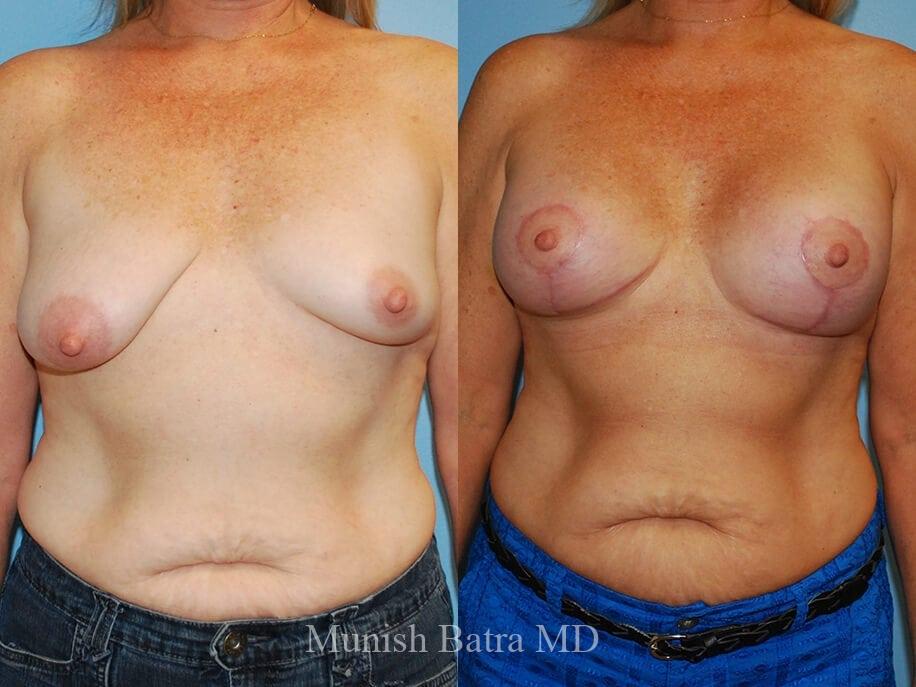 Before and After Image