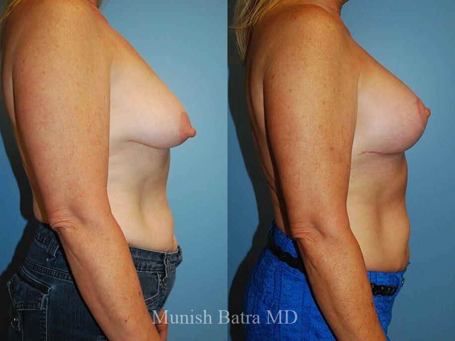 Before and After Image