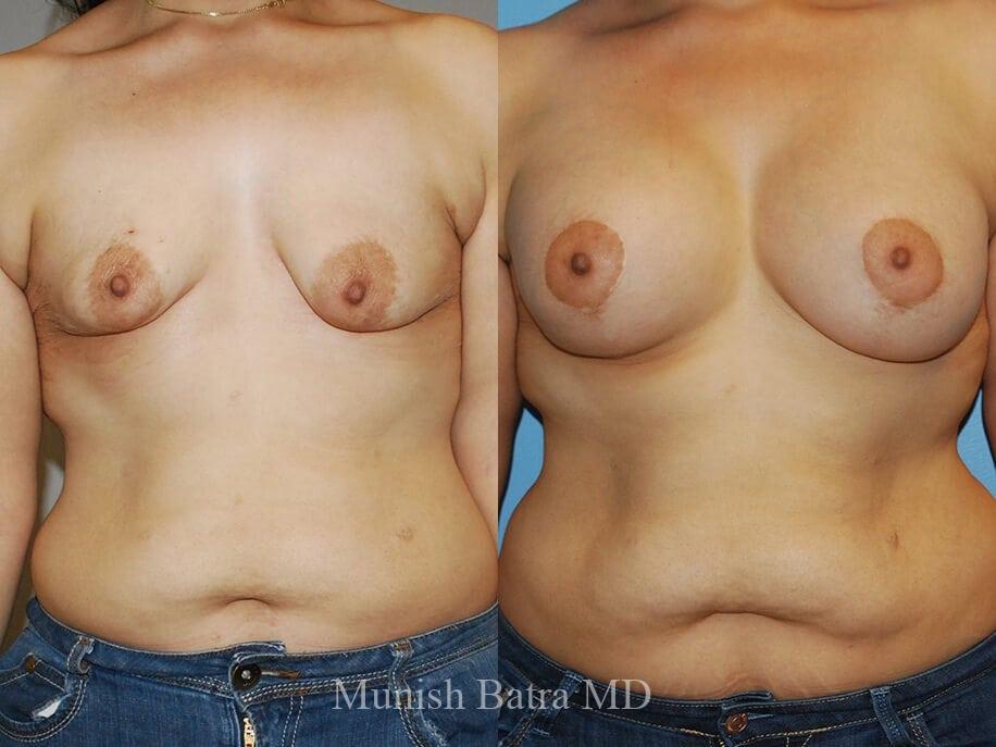 Before and After Image