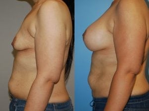Before and After Image