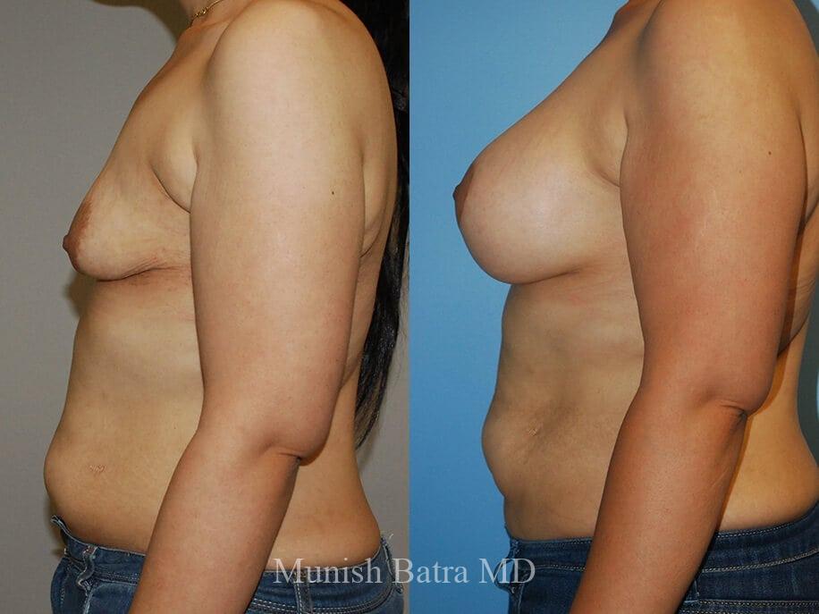Before and After Image