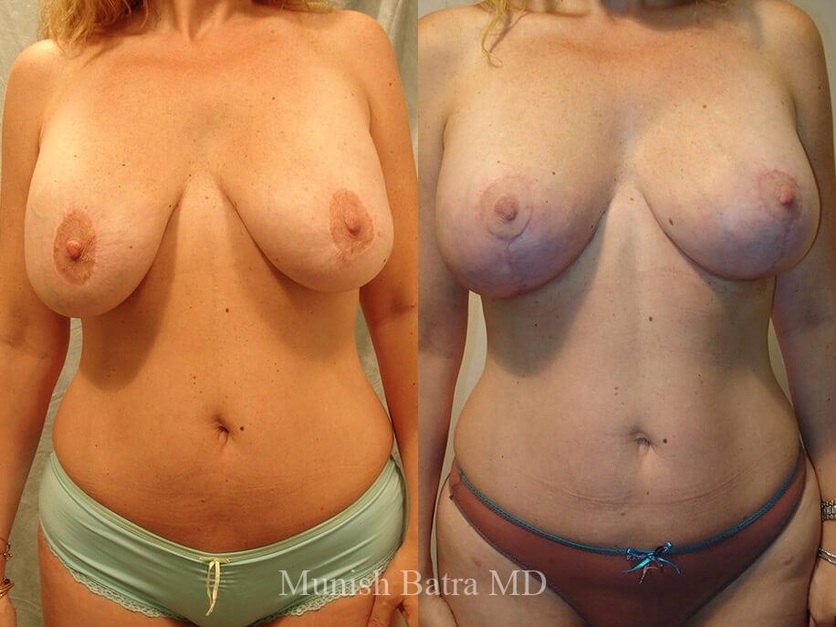 Before and After Image