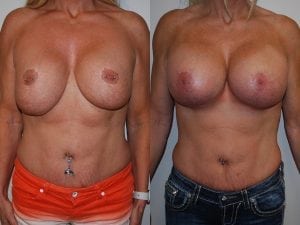 Before and After Image