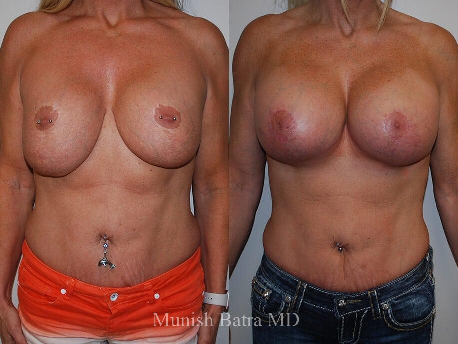 Before and After Image