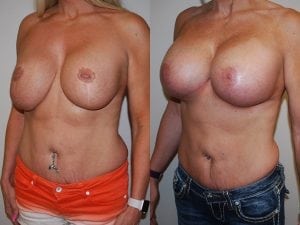 Before and After Image