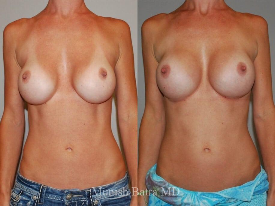 Before and After Image