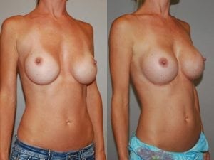 Before and After Image