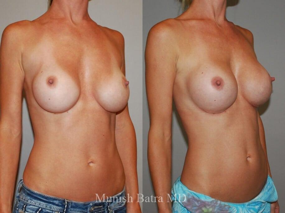 Before and After Image