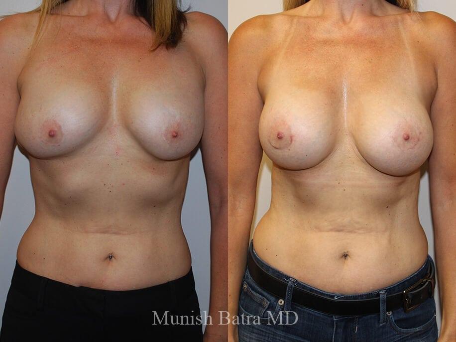 Before and After Image