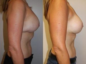 Before and After Image