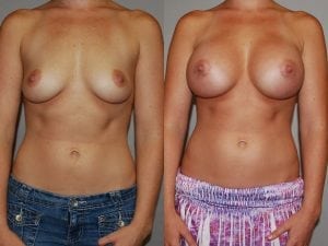 Before and After Image