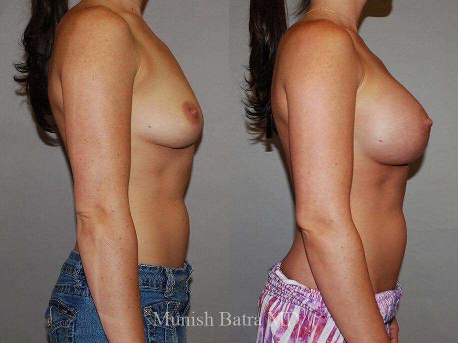 Before and After Image
