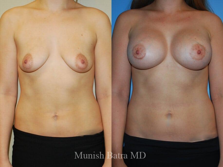 Before and After Image