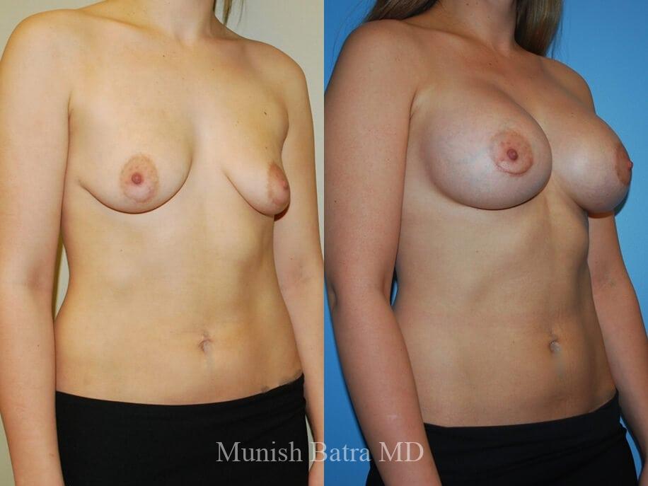 Before and After Image