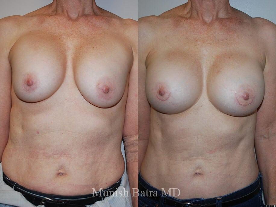 Before and After Image