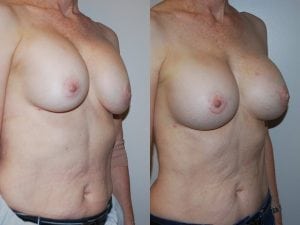 Before and After Image