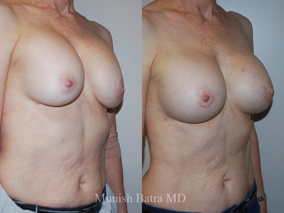 Before and After Image