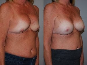 Before and After Image