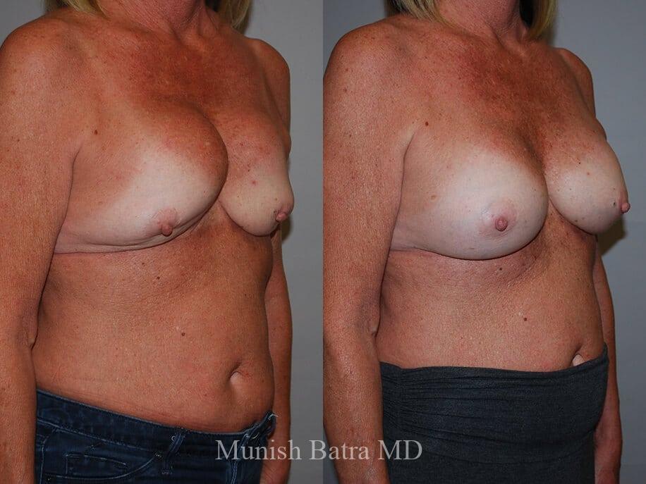 Before and After Image