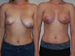 Before and After Image