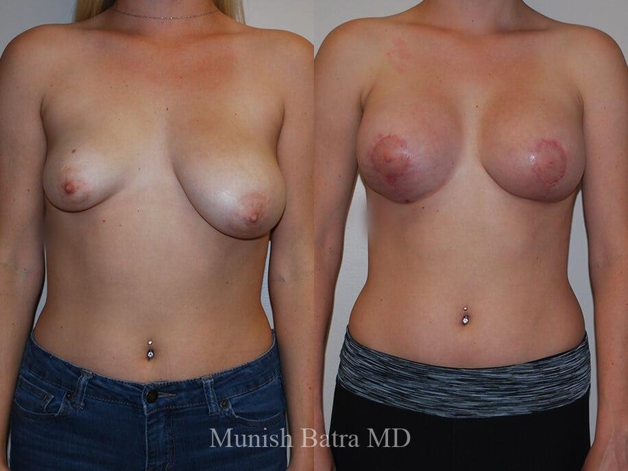 Before and After Image