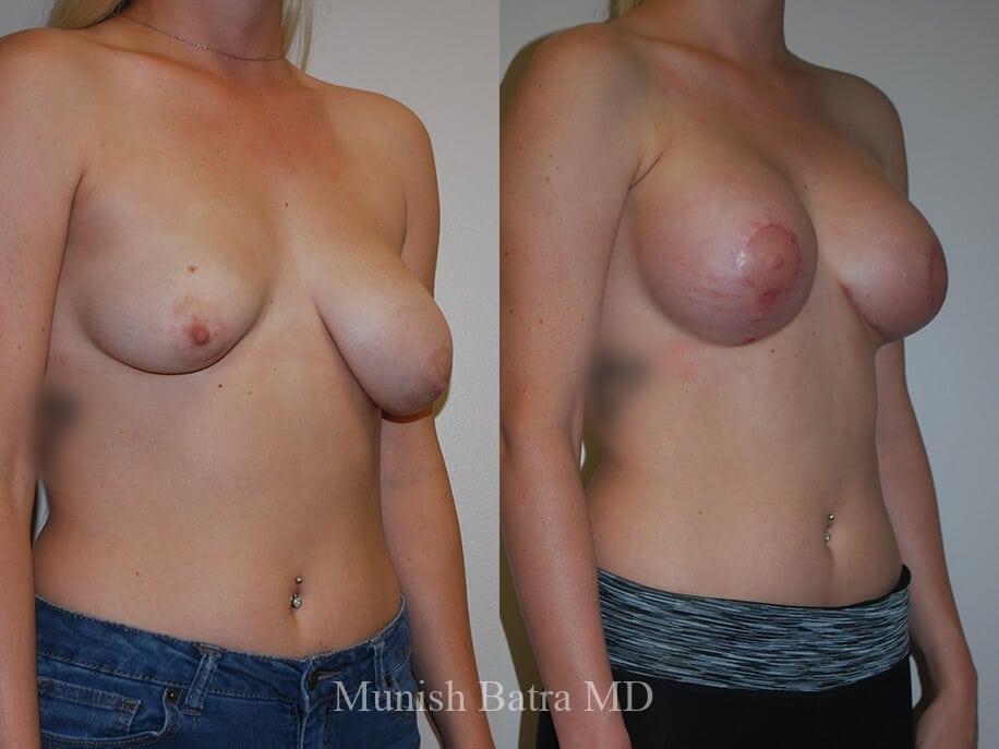 Before and After Image