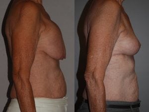 Before and After Image