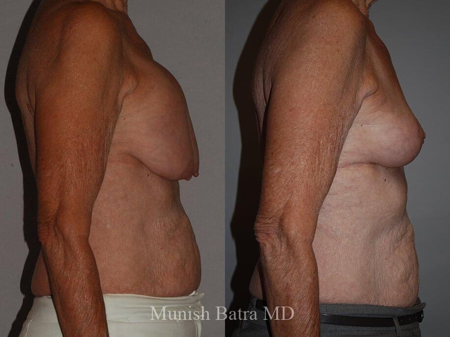 Before and After Image