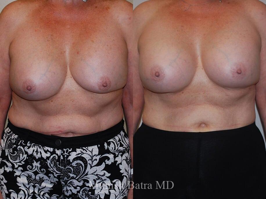 Before and After Image