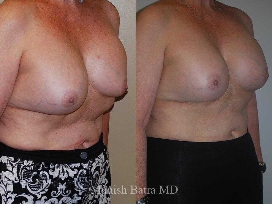 Before and After Image