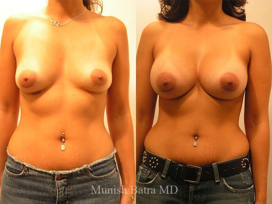 Before and After Image