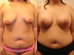Before and After Image