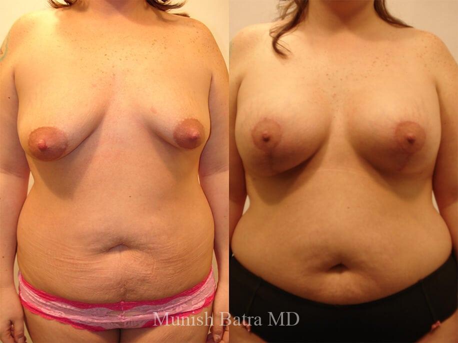 Before and After Image