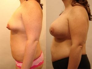 Before and After Image