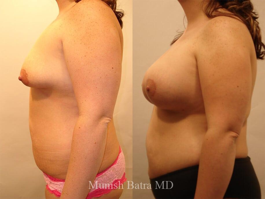 Before and After Image