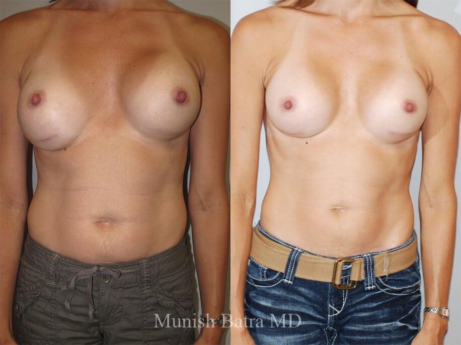 Before and After Image