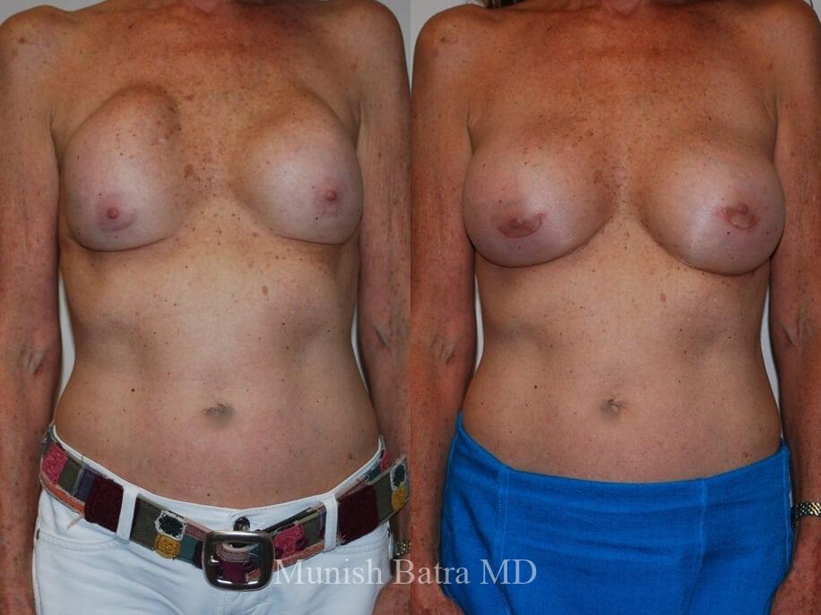 Before and After Image