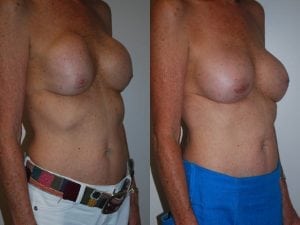 Before and After Image