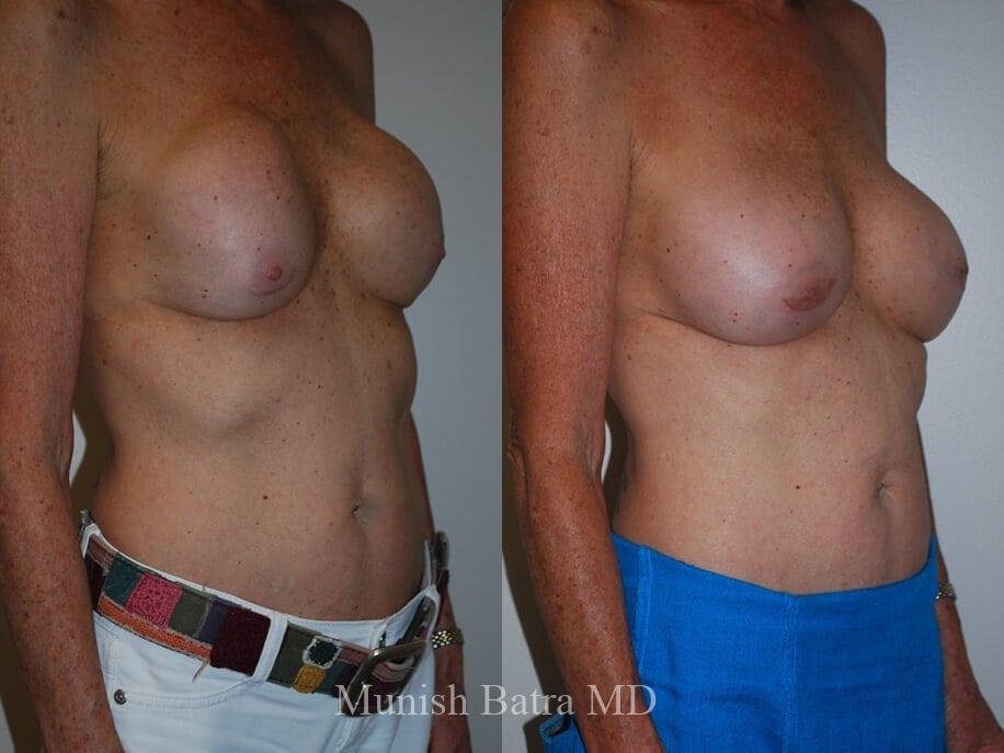 Before and After Image