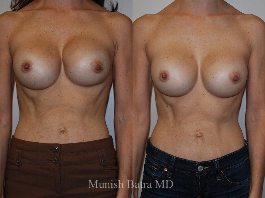 Before and After Image