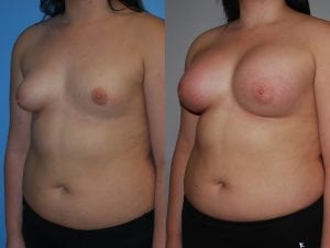 Before and After Image