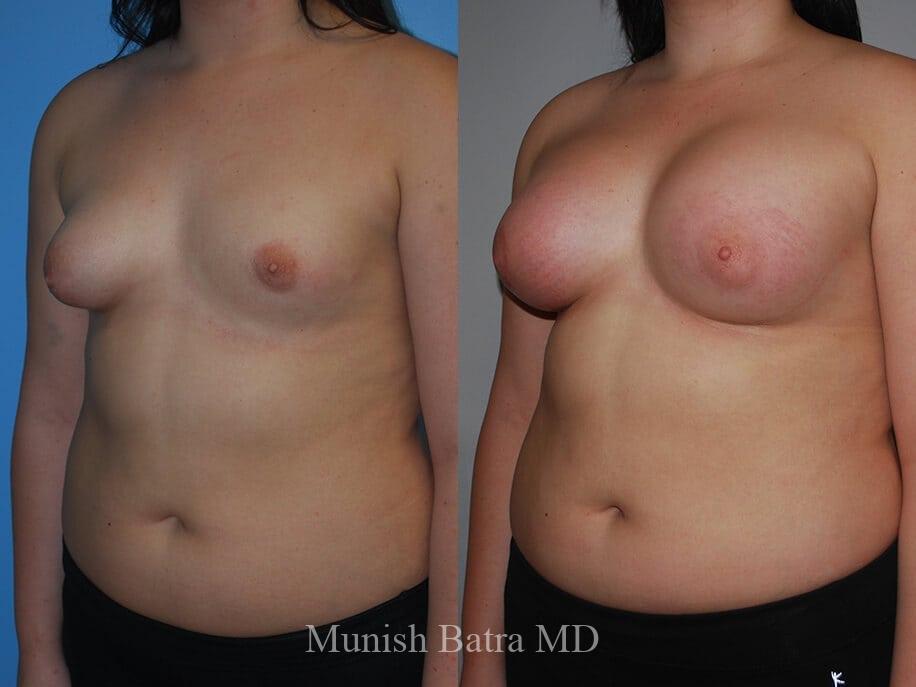 Before and After Image