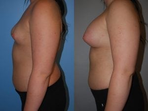 Before and After Image